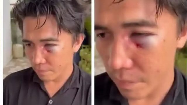 Gegara Petasan Seorang Pemuda di Maros Babak Belur Dianiaya Polisi