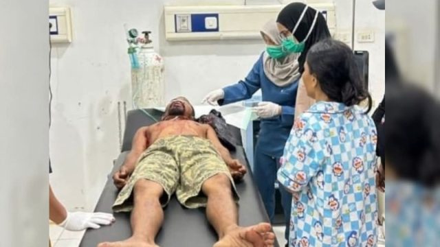 Warga Mesuji Lampung Ditembak Tetangga di Wajah, Polisi Sebut Pelaku Diburu