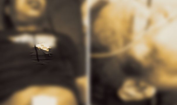 Ngeri !!! Begini Luka Tembak Akibat Cekcok Warga di Jabung Lampung Timur