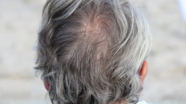 Rambutku Mulai Memutih, Umurku Tak Lagi Panjang, Kesadaran Waktu dan Akhir Kehidupan Perspektif Psikologi Terapan